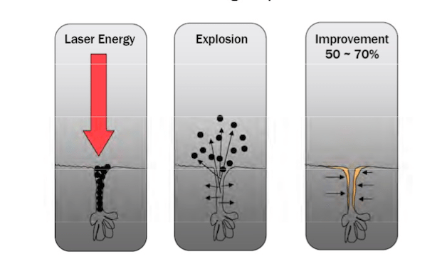 hemac-aesthetic-carbon-peel